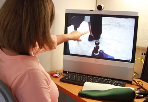 Virtual care point of view as a clinician views a Veteran's prosthetic leg Virtual care point of view as a clinician views a Veteran's prosthetic leg
